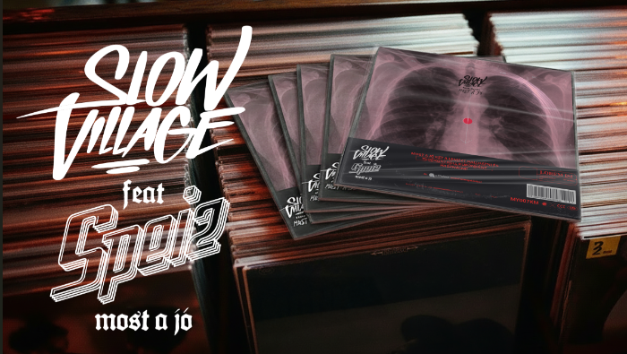 Slow Village feat Speiz - röntgenképre készült az új lemez, és fontos üzenete van az e-cigizőknek